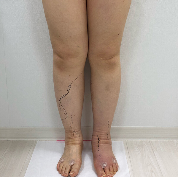 術前前方からのお写真