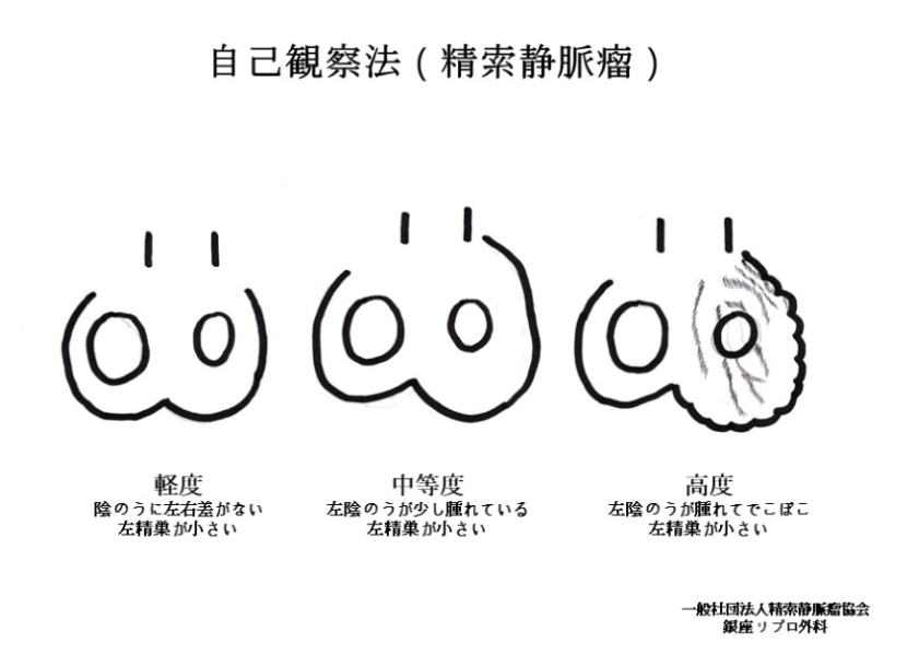 自己観察法